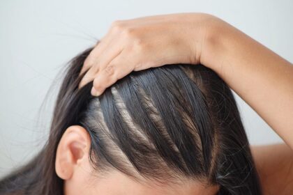 Top Benefits Of Undergoing Stem Cell Therapy For Hair At VCare
                        