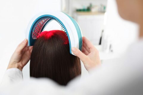 Top Benefits Of Undergoing Stem Cell Therapy For Hair At VCare
                        