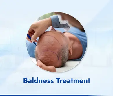 Baldness Treatment Image