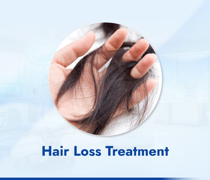 Hair Loss Treatment