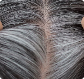 Premature-Greying treatment